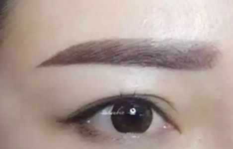 南昌美伊爾醫(yī)院的劉立軍醫(yī)生手術(shù)實(shí)力如何？擅長(zhǎng)哪些手術(shù)？附真實(shí)案例為參考