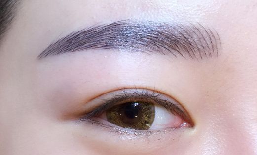 徐利剛：杭州藝星整形臨床實力派！鼻子整形解析，案例詳解！