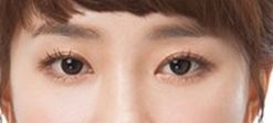 合肥萊司美醫(yī)療美容門(mén)診部詳細(xì)位置查詢(xún)，洪圣澤雙眼皮成功案例震撼來(lái)襲！