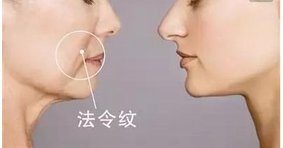 韋元強(qiáng)swan吸脂修復(fù)方法介紹，相關(guān)醫(yī)院推薦