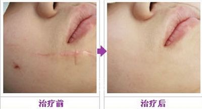 重慶神奇醫(yī)療機構(gòu)，致力于脂肪填充醫(yī)療服務(wù)的機構(gòu)盤點