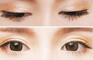青島壹美天成整形醫(yī)院的隆鼻技術(shù)如何？看看這些真實案例！