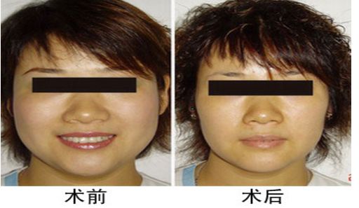 北京祛斑醫(yī)院三甲排行榜：北京哪家祛斑醫(yī)院好？