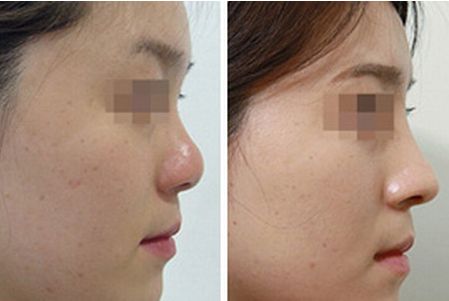 德陽有哪些靠譜的去妊娠紋的醫(yī)院？