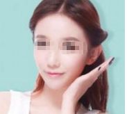 首屈一指的北京瘦身?？漆t(yī)院排行榜