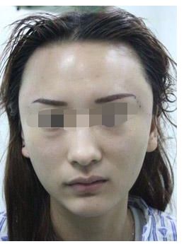 浙江地區(qū)有哪些知名鼻部整形私立醫(yī)院？