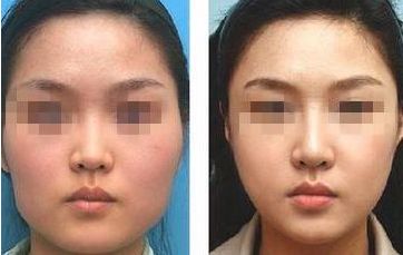 南通瘦身整形醫(yī)院哪家專業(yè)？