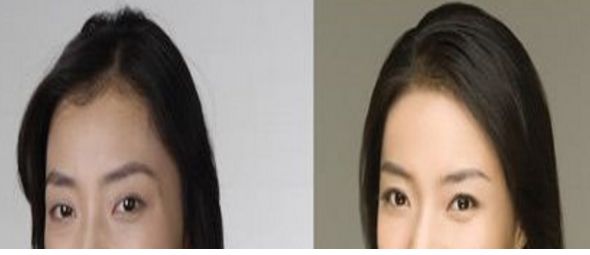 成都悅己醫(yī)美醫(yī)生實(shí)力強(qiáng)，顧客口碑好價格合適