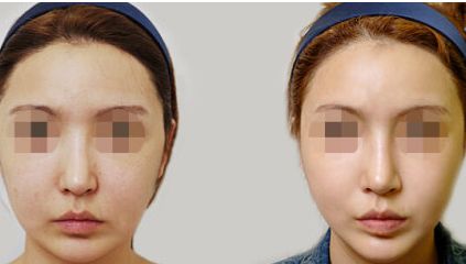 深圳七和醫(yī)美口碑如何？技術(shù)實力+醫(yī)生團隊+特色項目解析