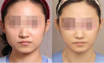 湛江有哪些頂尖整形美容醫(yī)院值得關(guān)注？