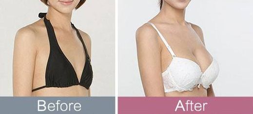 東莞哪家整形醫(yī)院頗受推薦？