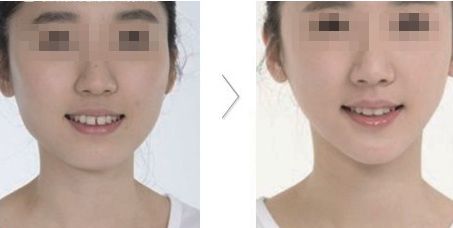 哪家醫(yī)院在北京具有卓越的醫(yī)美科技和服務(wù)？歐洲醫(yī)學(xué)中心、北京協(xié)和、北大人民醫(yī)院等公立單位有何特色？