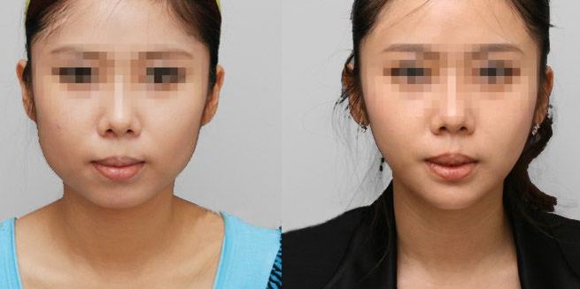 蘭州哪家整形醫(yī)院口碑好？看看排名榜單！