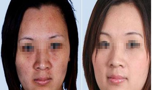 3家值得信賴(lài)的廣州整形醫(yī)院推薦 3家值得信賴(lài)的廣州整形醫(yī)院推薦