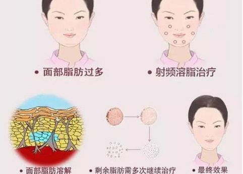 徐州二院整形美容科專家評價及服務(wù)項目介紹，陶常波醫(yī)生特長領(lǐng)域一覽