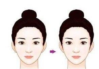 深圳哪家醫(yī)院的隆鼻效果好？醫(yī)生口碑怎么樣？