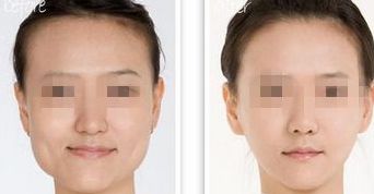 黑龍江三甲整形醫(yī)院熱門榜單，前三強大揭秘！
