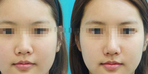 成都市吸脂手術在哪兒可以做？