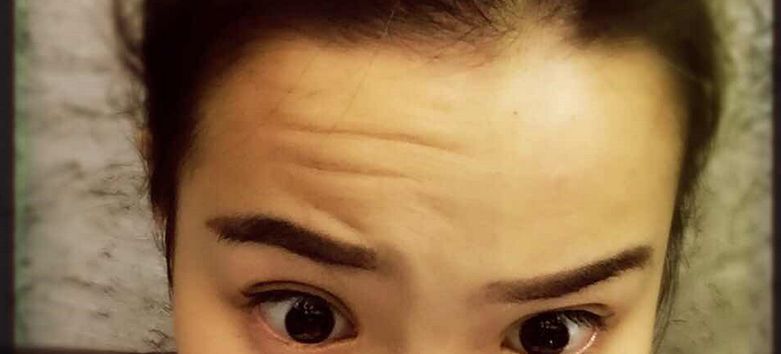 深圳哪幾家醫(yī)美整形醫(yī)院口碑最好？