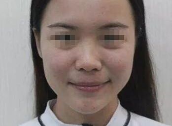 南充疤痕整形醫(yī)院排名精選，助你尋找完美去疤痕之旅