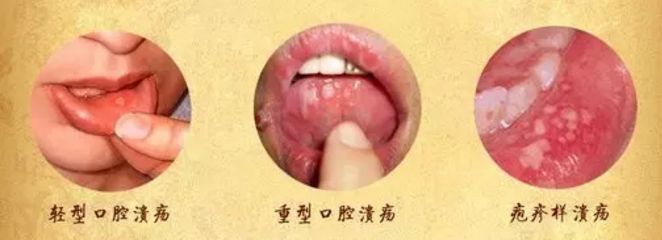 北京眼袋整形醫(yī)院排名大揭秘，最佳去眼袋選擇！