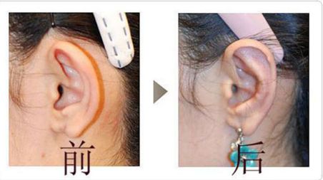 成都友誼醫(yī)院疤痕科：設(shè)備先進(jìn)、技術(shù)精湛，治療效果如何？