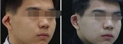 北京三甲隆胸醫(yī)院排名公布：哪家醫(yī)院技術(shù)過硬，值得信賴？