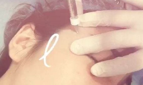 深圳前海地區(qū)哪家整形醫(yī)院比較靠譜？好的深圳整容醫(yī)院有哪些？