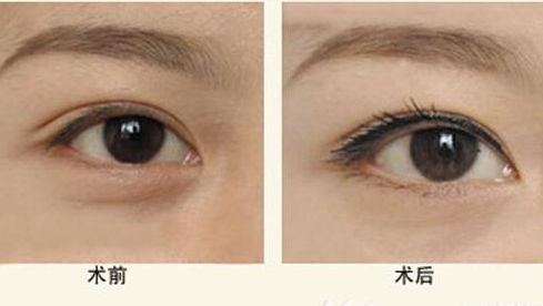 樂山人民醫(yī)院醫(yī)生特色項(xiàng)目與服務(wù)評(píng)價(jià)全解析 樂山人民醫(yī)院醫(yī)生特色項(xiàng)目與服務(wù)評(píng)價(jià)全解析