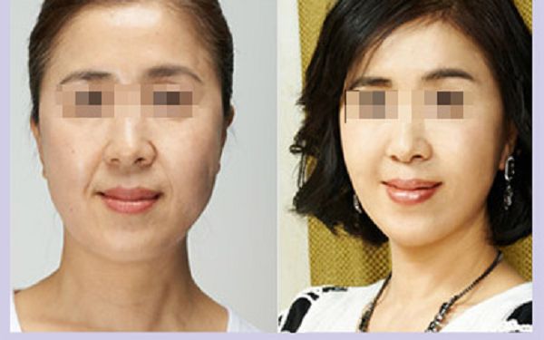 溫州哪家整形醫(yī)院口碑好？排名榜單揭曉