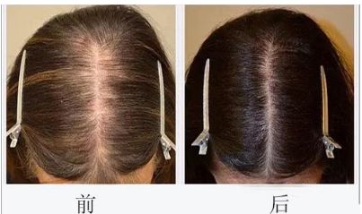 溫州粉范整形醫(yī)院坐診醫(yī)生團(tuán)隊(duì)的技術(shù)和2023服務(wù)水準(zhǔn)綜合解析