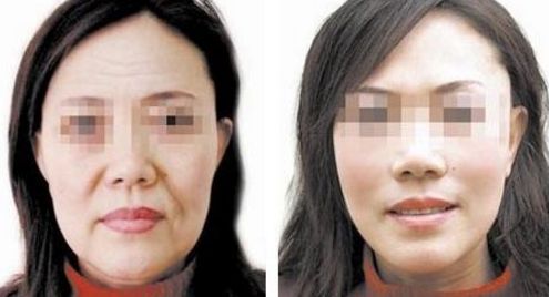 洛陽整容醫(yī)院排名與評價(jià) 洛陽整容醫(yī)院排名與評價(jià)