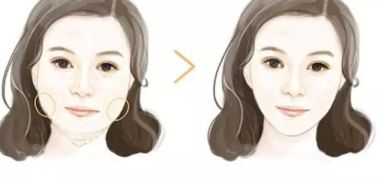 大連市哪些醫(yī)院是專業(yè)的開眼角整形中心？