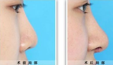 臨汾臻容醫(yī)療美容門(mén)診部詳解：技術(shù)水平、服務(wù)項(xiàng)目與價(jià)格清單
