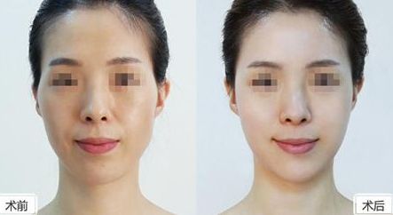深圳美萊整形醫(yī)院位置介紹，牽手醫(yī)生，搶先體驗熱門項目