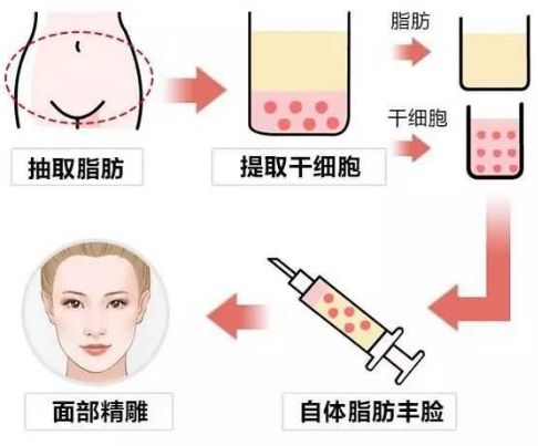 深圳哪家口碑好的整形醫(yī)院值得推薦