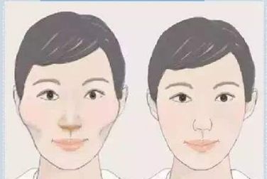 雙眼皮術(shù)后護(hù)理全攻略：埋線和全切有何異同？多久恢復(fù)自然？