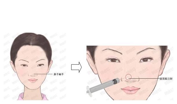 邯鄲萊媚儷整形：價(jià)格實(shí)惠，專業(yè)修復(fù)，雙眼皮、隆鼻等項(xiàng)目詳解！