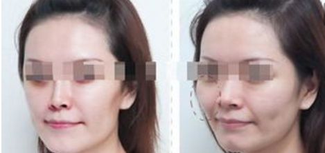 杭州整形美容醫(yī)院排名前六，你值得了解的每一家！