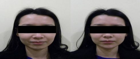 優(yōu)質(zhì)整形醫(yī)院排行榜，找哪家吸脂效果好？