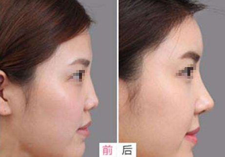 重慶小柯麗格口碑揭秘：權威機構認證，美麗蛻變首選