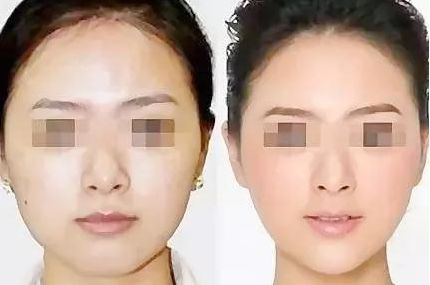 在廣東，如何選擇心儀的醫(yī)美機(jī)構(gòu)？（附醫(yī)院推薦）