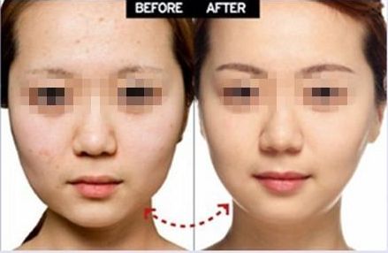 上海眼部整形醫(yī)院推薦，雙眼皮修復(fù)效果好