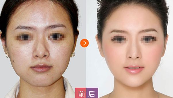 邢臺博愛高健整容致命嗎？高健整容水平值得信賴！