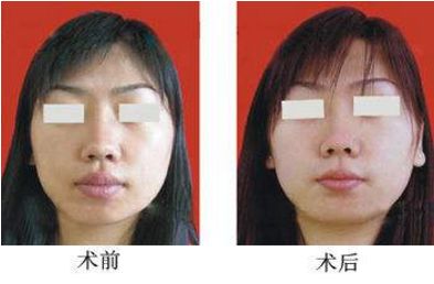 南寧愛思特整形好不好？哪位醫(yī)生技術(shù)好？有什么項目？