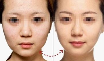 南京優(yōu)質(zhì)整容醫(yī)院排名及美容服務(wù)一覽