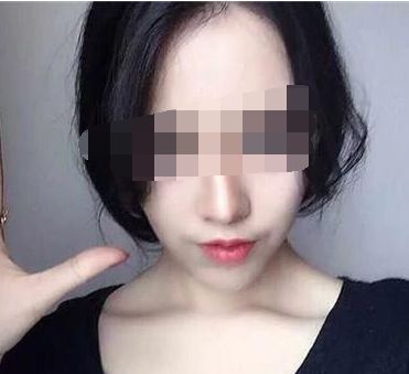 昆明市的美容整形醫(yī)院有哪些值得推薦？