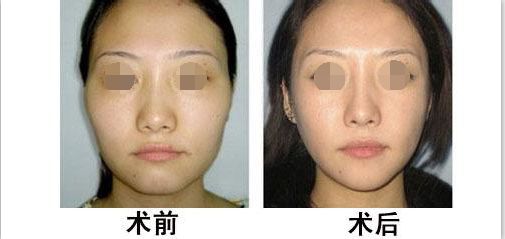 蘭州有哪些專業(yè)整形醫(yī)院值得去？