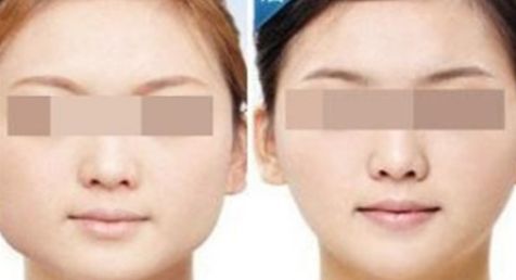 2024大連哪家醫(yī)院吸脂效果最好？這里有前十名匯總！