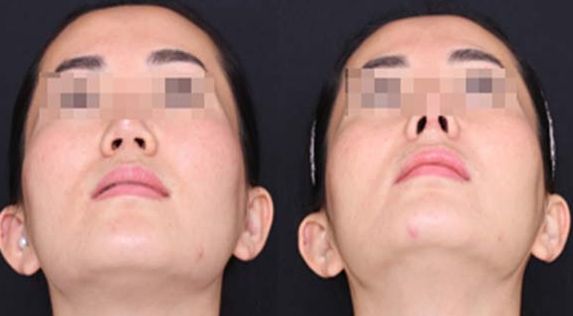 重慶哪家整形醫(yī)院口碑好？專業(yè)整形醫(yī)院推薦匯總